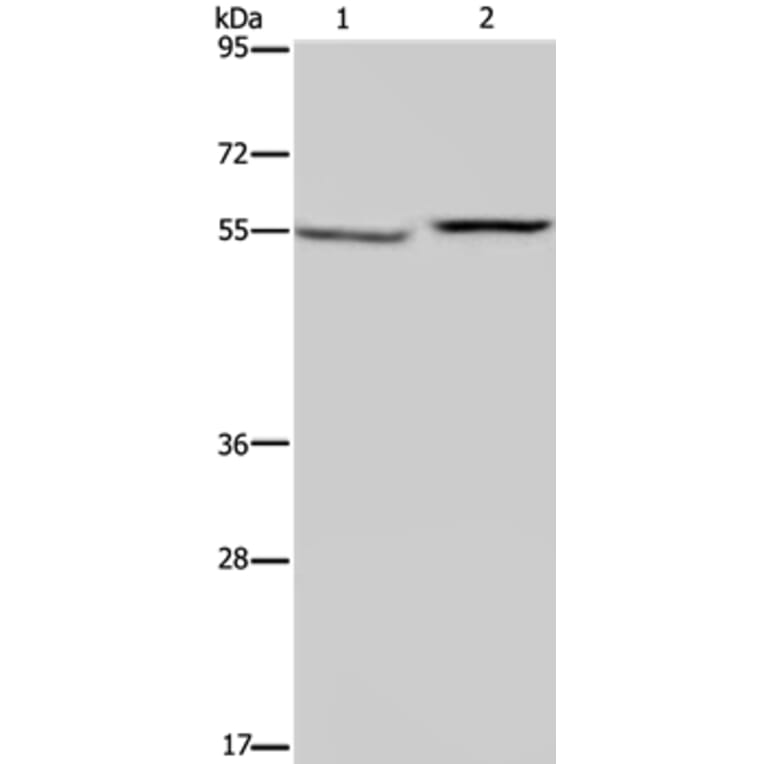 PHGDH Antibody from Signalway Antibody (37821) - Antibodies.com