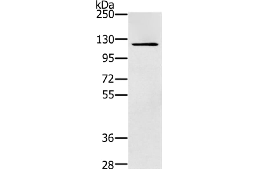 ZMIZ1 Antibody from Signalway Antibody (37868) - Antibodies.com