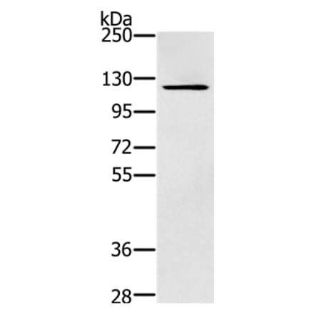 ZMIZ1 Antibody from Signalway Antibody (37868) - Antibodies.com