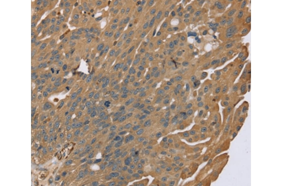 Immunohistochemistry - ZMIZ1 Antibody from Signalway Antibody (37868) - Antibodies.com
