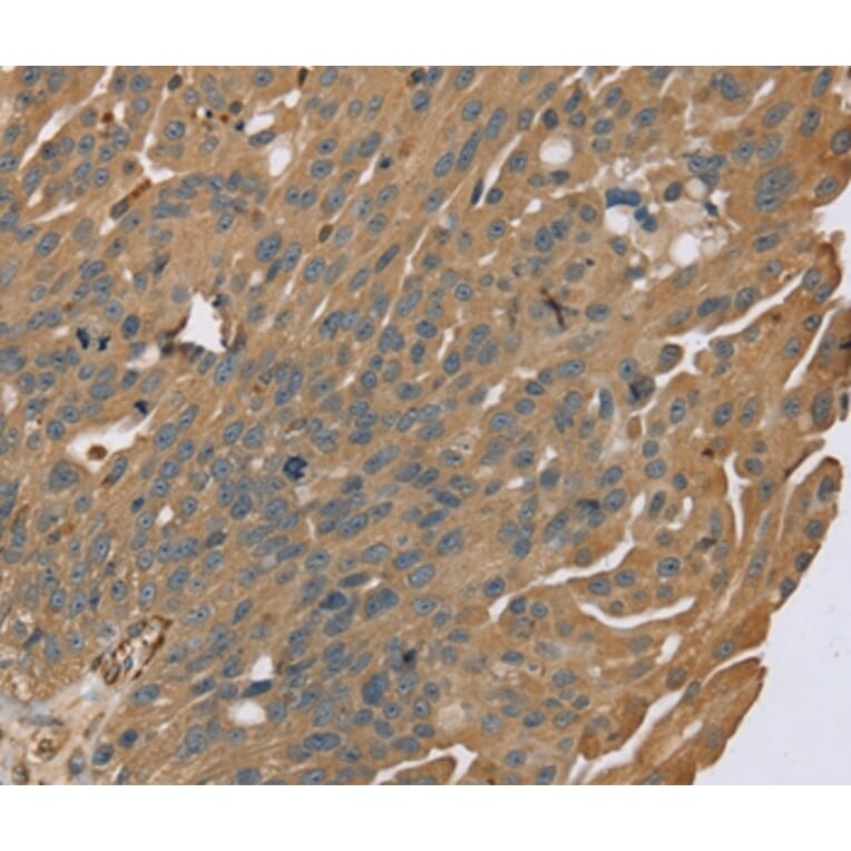 Immunohistochemistry - ZMIZ1 Antibody from Signalway Antibody (37868) - Antibodies.com