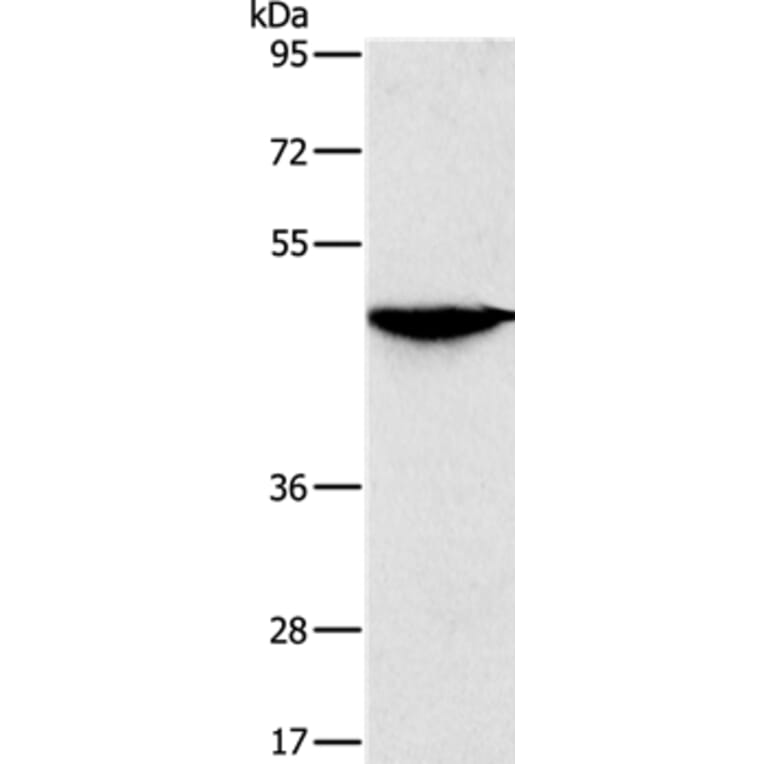 SOX11 Antibody from Signalway Antibody (37970) - Antibodies.com