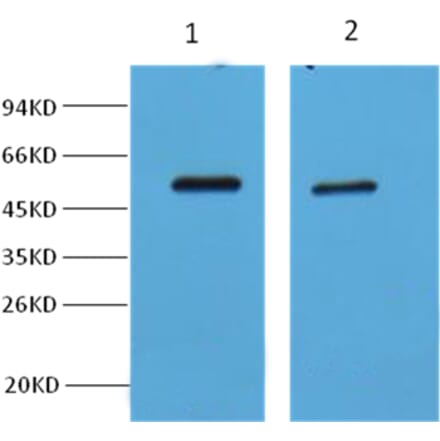 Western blot - MeCP2 Antibody from Signalway Antibody (38000) - Antibodies.com