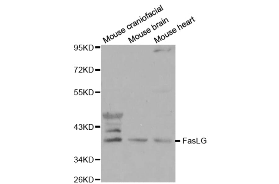 Western blot - FasLG antibody from Signalway Antibody (38108) - Antibodies.com