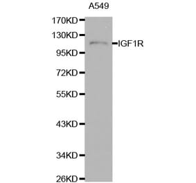 Western blot - IGF1R antibody from Signalway Antibody (38111) - Antibodies.com