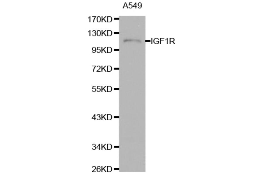 Western blot - IGF1R antibody from Signalway Antibody (38111) - Antibodies.com