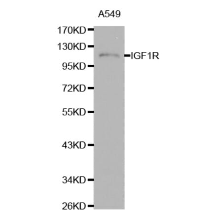 Western blot - IGF1R antibody from Signalway Antibody (38111) - Antibodies.com