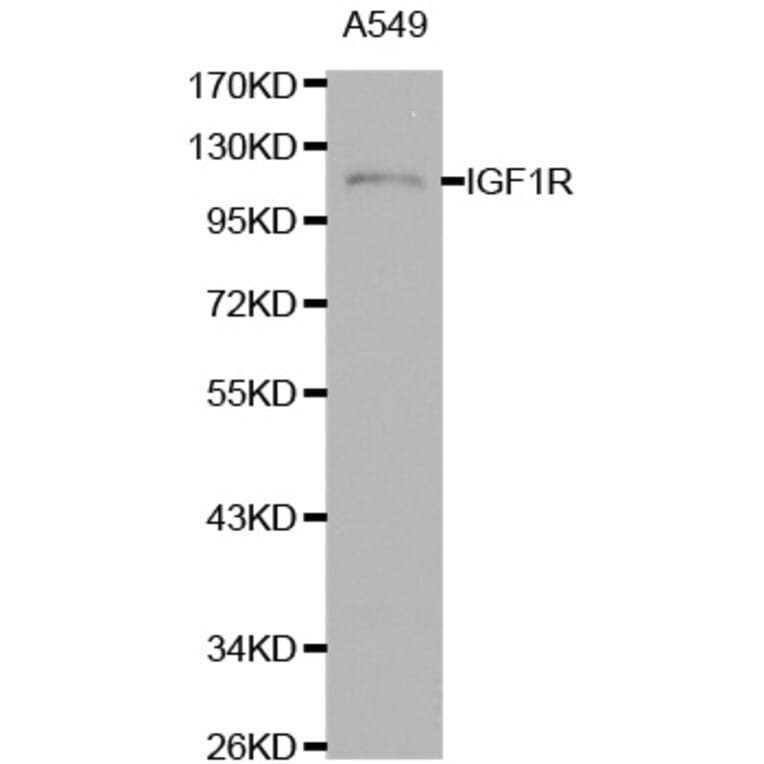 Western blot - IGF1R antibody from Signalway Antibody (38111) - Antibodies.com