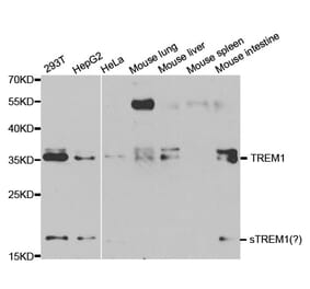 Western blot - TREM1 antibody from Signalway Antibody (38127) - Antibodies.com