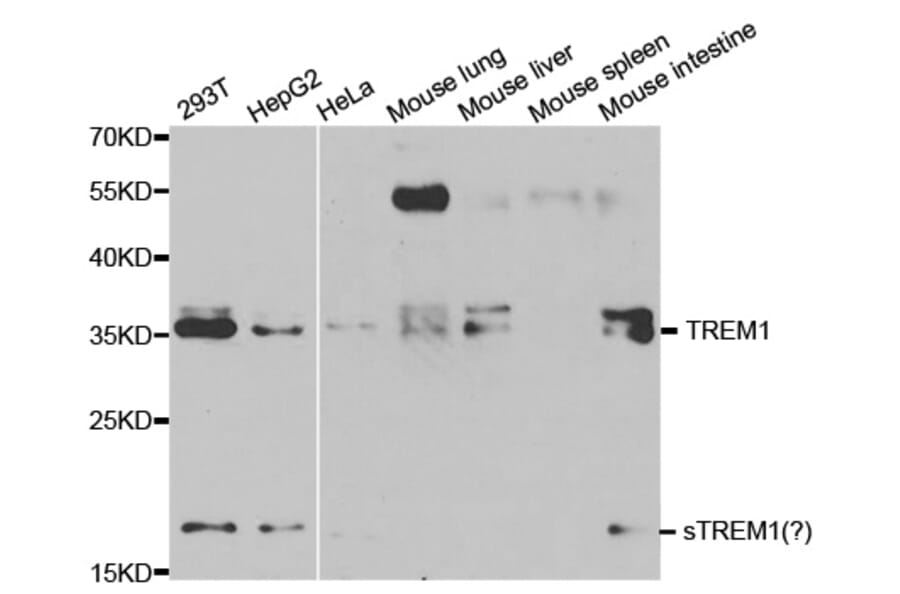 Western blot - TREM1 antibody from Signalway Antibody (38127) - Antibodies.com