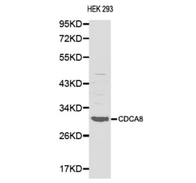 Western blot - CDCA8 antibody from Signalway Antibody (38138) - Antibodies.com