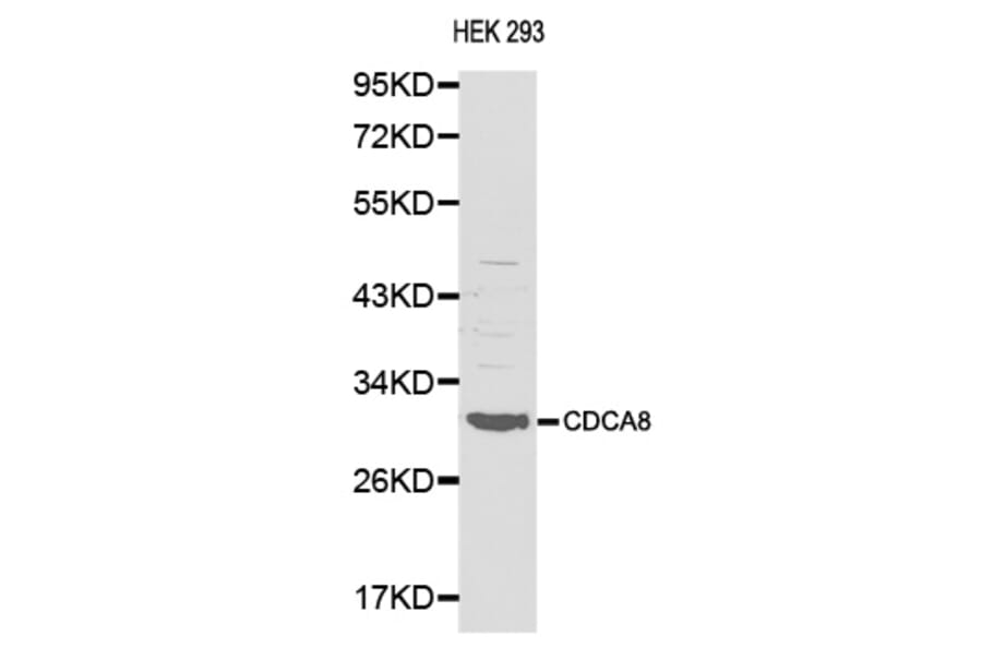 Western blot - CDCA8 antibody from Signalway Antibody (38138) - Antibodies.com