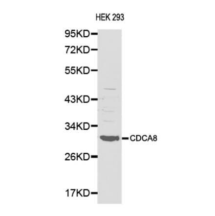 Western blot - CDCA8 antibody from Signalway Antibody (38138) - Antibodies.com