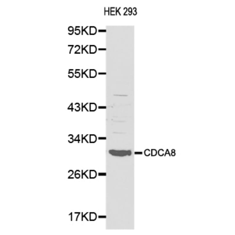 Western blot - CDCA8 antibody from Signalway Antibody (38138) - Antibodies.com