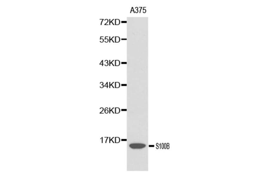 Western blot - S100B antibody from Signalway Antibody (38139) - Antibodies.com