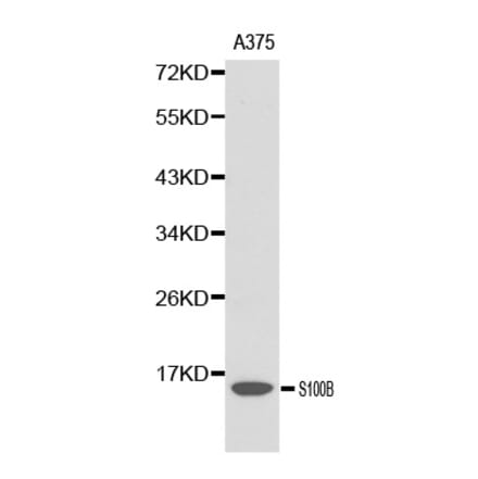 Western blot - S100B antibody from Signalway Antibody (38139) - Antibodies.com