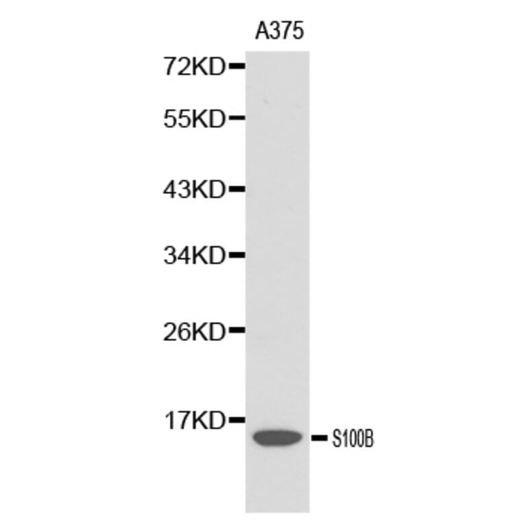 Western blot - S100B antibody from Signalway Antibody (38139) - Antibodies.com
