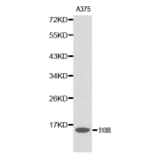 Western blot - S100B antibody from Signalway Antibody (38139) - Antibodies.com