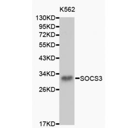 Western blot - SOCS3 antibody from Signalway Antibody (38150) - Antibodies.com