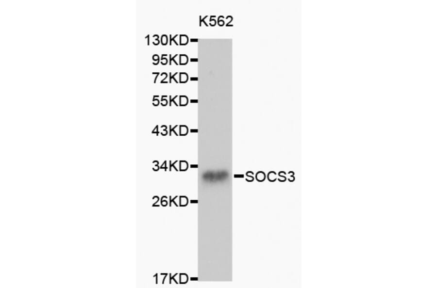 Western blot - SOCS3 antibody from Signalway Antibody (38150) - Antibodies.com
