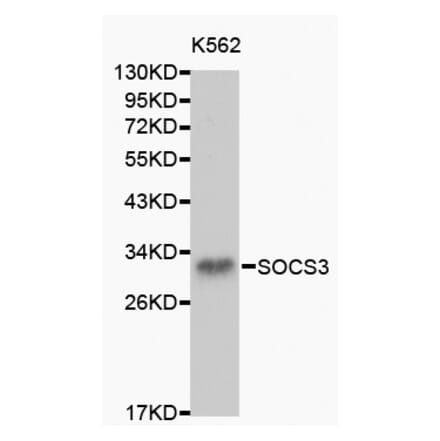 Western blot - SOCS3 antibody from Signalway Antibody (38150) - Antibodies.com