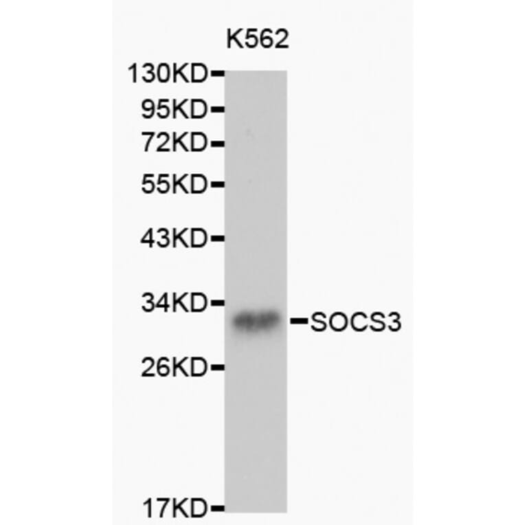 Western blot - SOCS3 antibody from Signalway Antibody (38150) - Antibodies.com