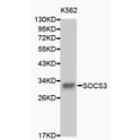 Western blot - SOCS3 antibody from Signalway Antibody (38150) - Antibodies.com