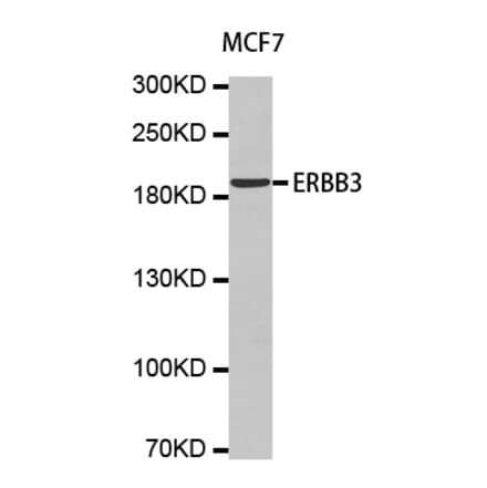 Western blot - ERBB3 antibody from Signalway Antibody (38154) - Antibodies.com