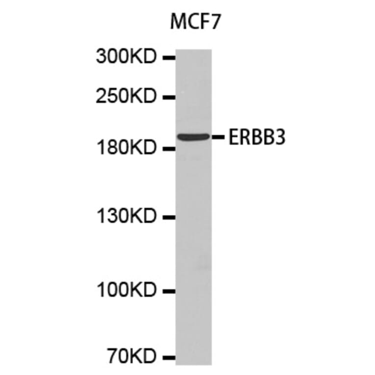 Western blot - ERBB3 antibody from Signalway Antibody (38154) - Antibodies.com