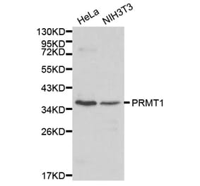 Western blot - PRMT1 antibody from Signalway Antibody (38170) - Antibodies.com