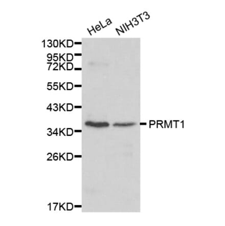 Western blot - PRMT1 antibody from Signalway Antibody (38170) - Antibodies.com