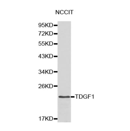 Western blot - TDGF1 antibody from Signalway Antibody (38173) - Antibodies.com