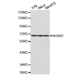 Western blot - NUAK2 antibody from Signalway Antibody (38178) - Antibodies.com