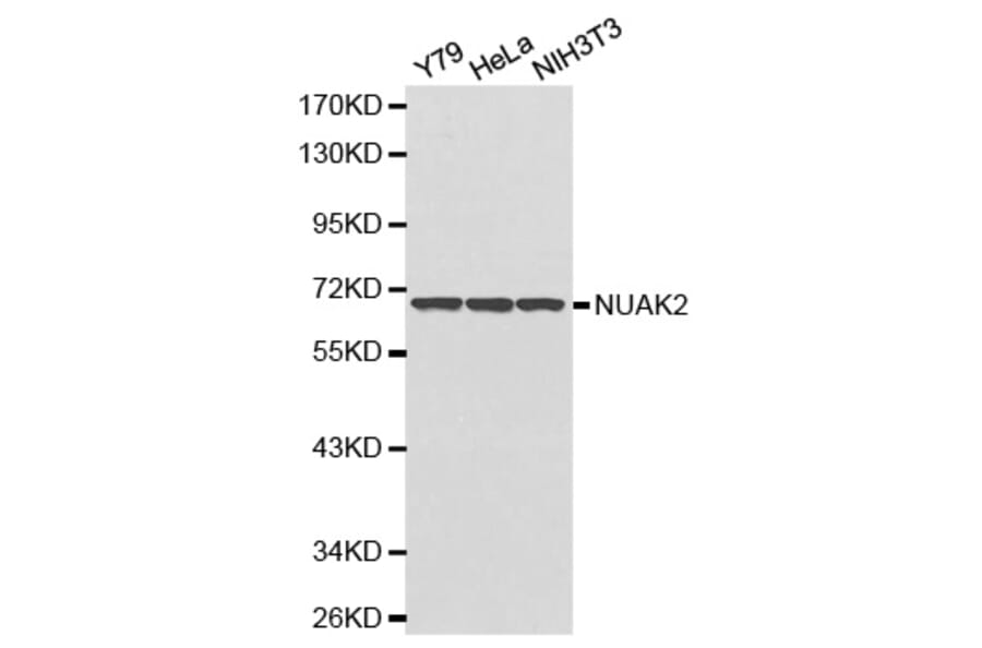Western blot - NUAK2 antibody from Signalway Antibody (38178) - Antibodies.com