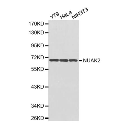 Western blot - NUAK2 antibody from Signalway Antibody (38178) - Antibodies.com