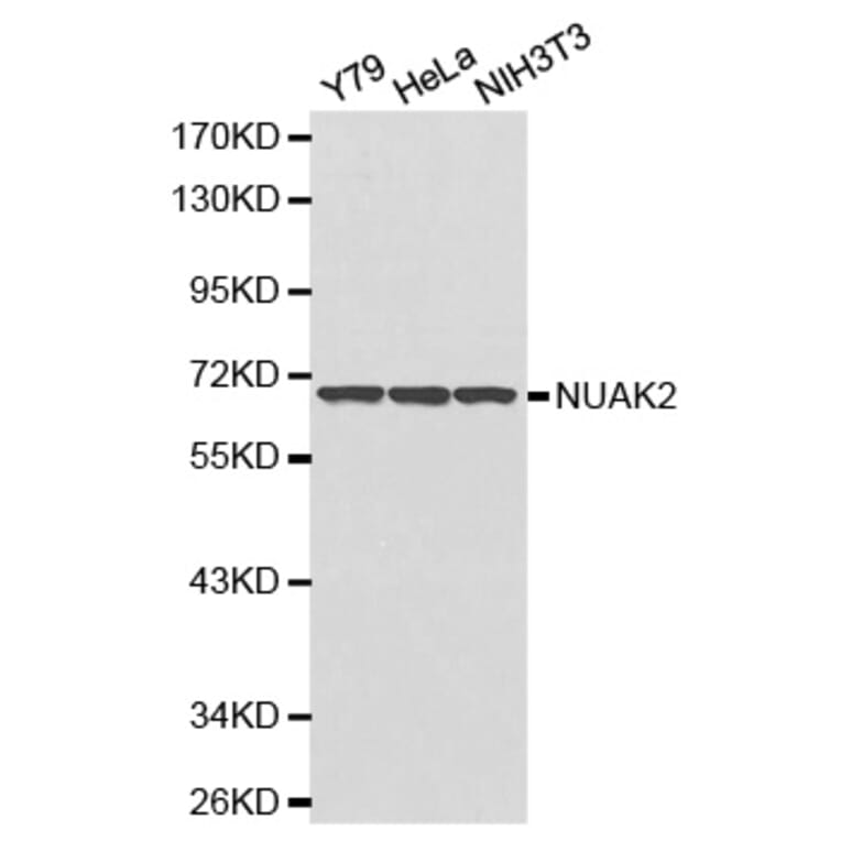 Western blot - NUAK2 antibody from Signalway Antibody (38178) - Antibodies.com