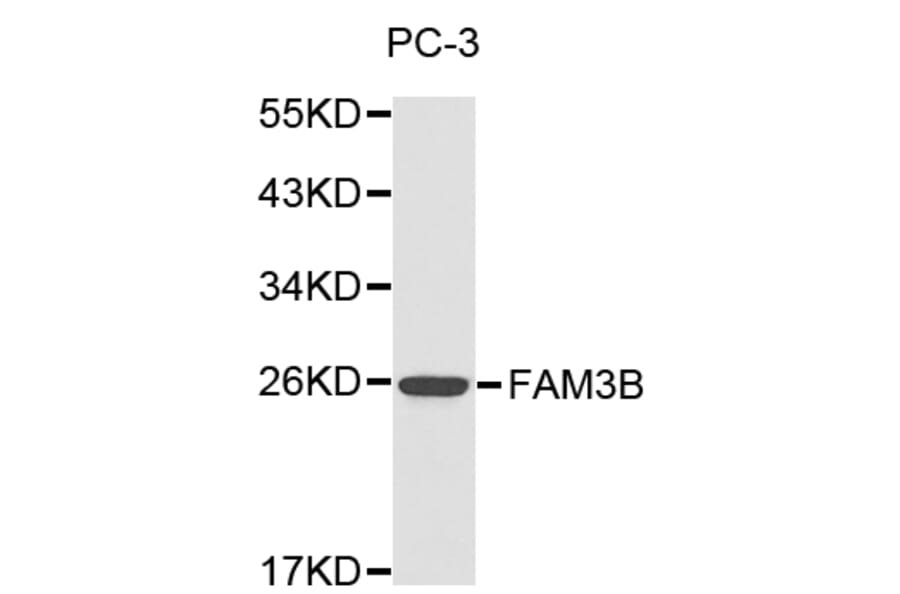 Western blot - FAM3B antibody from Signalway Antibody (38181) - Antibodies.com