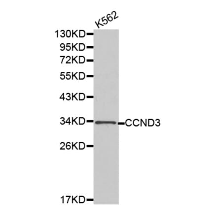 Western blot - CCND3 antibody from Signalway Antibody (38183) - Antibodies.com