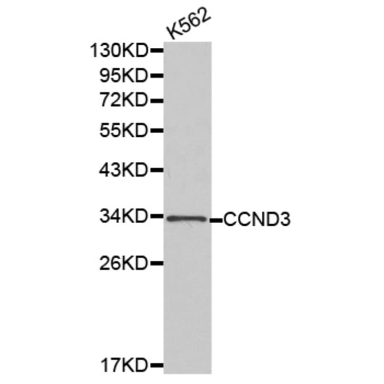 Western blot - CCND3 antibody from Signalway Antibody (38183) - Antibodies.com