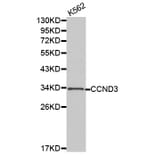 Western blot - CCND3 antibody from Signalway Antibody (38183) - Antibodies.com