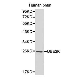 Western blot - UBE2K antibody from Signalway Antibody (38184) - Antibodies.com