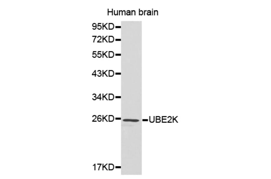 Western blot - UBE2K antibody from Signalway Antibody (38184) - Antibodies.com