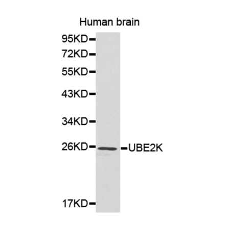 Western blot - UBE2K antibody from Signalway Antibody (38184) - Antibodies.com