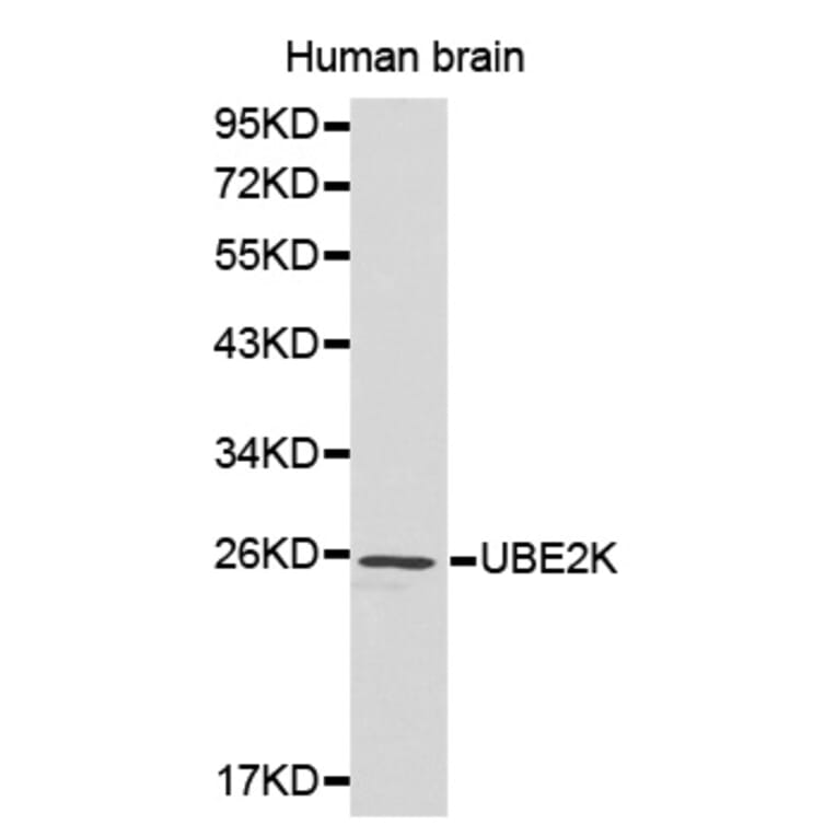 Western blot - UBE2K antibody from Signalway Antibody (38184) - Antibodies.com