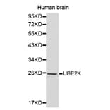 Western blot - UBE2K antibody from Signalway Antibody (38184) - Antibodies.com