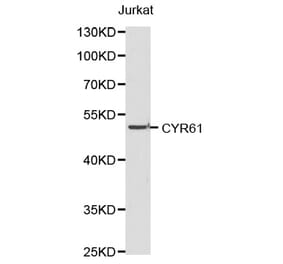Western blot - CYR61 antibody from Signalway Antibody (38189) - Antibodies.com