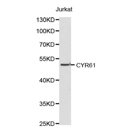 Western blot - CYR61 antibody from Signalway Antibody (38189) - Antibodies.com