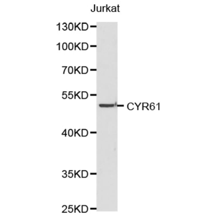 Western blot - CYR61 antibody from Signalway Antibody (38189) - Antibodies.com