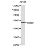Western blot - CYR61 antibody from Signalway Antibody (38189) - Antibodies.com