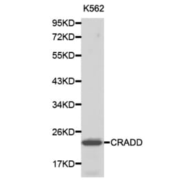 Western blot - CRADD antibody from Signalway Antibody (38194) - Antibodies.com